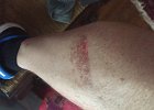 Chris Leg wound