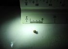 KidneyStone2016 (7)